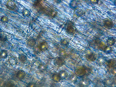 An oospore under a microscope.