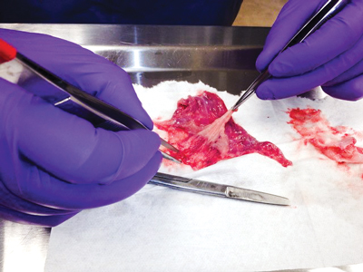 hands separating fetal placenta