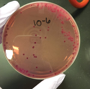petri dish with E. coli bacteria